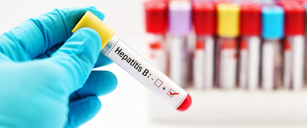 Wat is Hepatitis B? Wat zijn de symptomen en behandelmethoden?